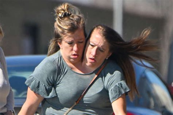 Abby and brittany hensel today acetobrazil