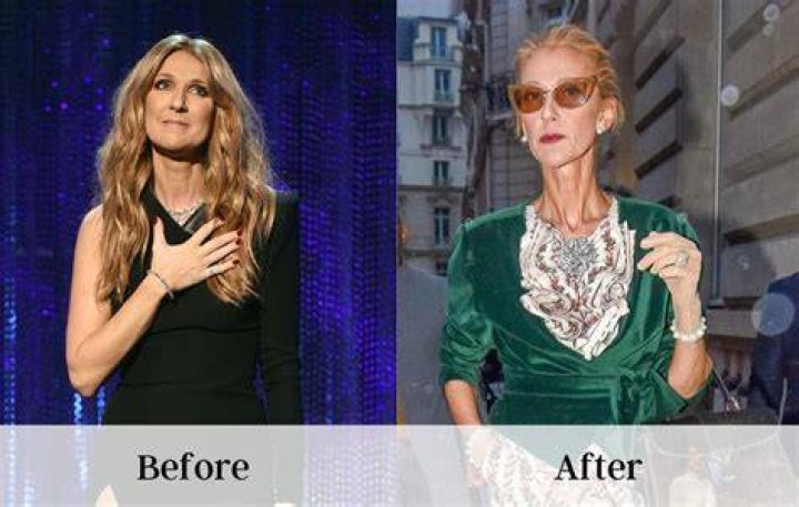 Céline Dion weight loss how did the singer lose weight? The Irish Sun