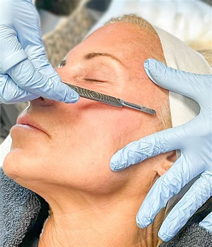 Dermaplaning Treatment (Facial with LED) Dermatique Med Spa Laser