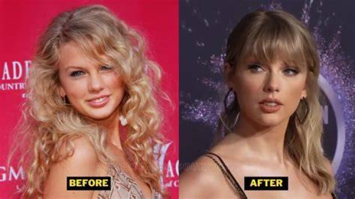 Did Taylor Swift get breast implants? Page Six