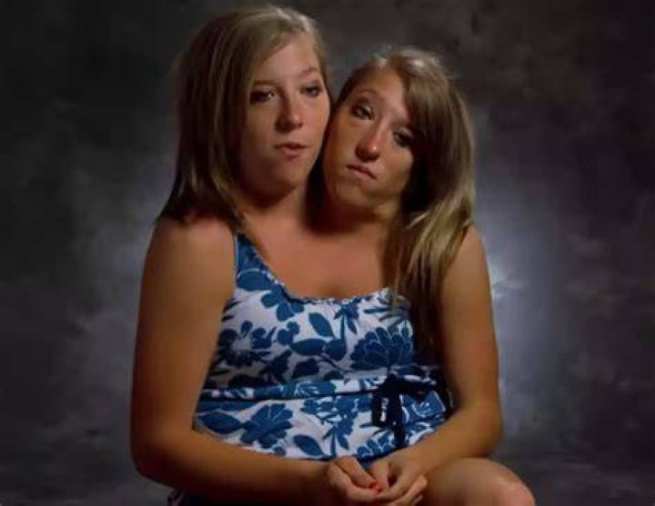 Here’s What Conjoined Twins Abby And Brittany Hensel Look Like Today