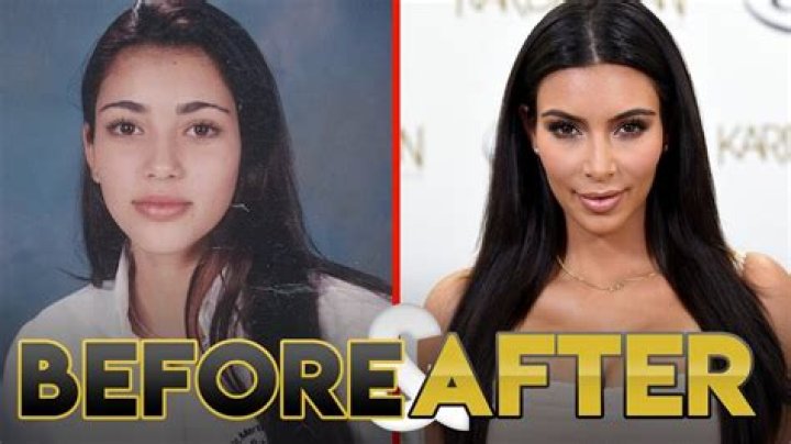 Kim Kardashian Before Plastic Surgery Pics