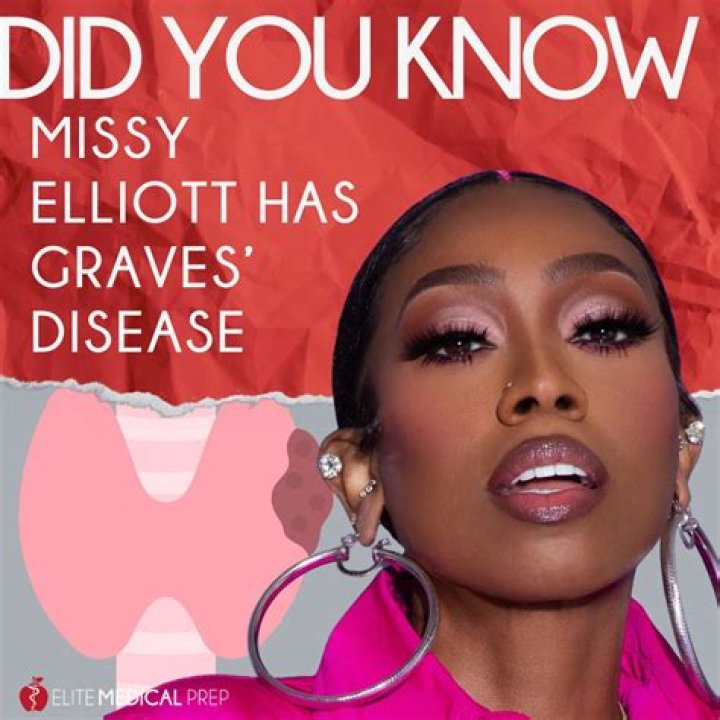 Missy Elliott Graves Disease Captions Ideas