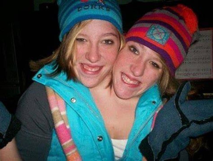 Pin by Bizby on 2 Heads Are Better Than 1 Conjoined twins, Twins