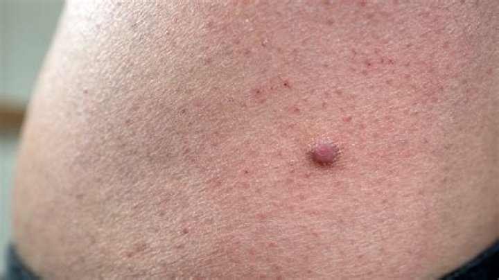 Pin on Eustose