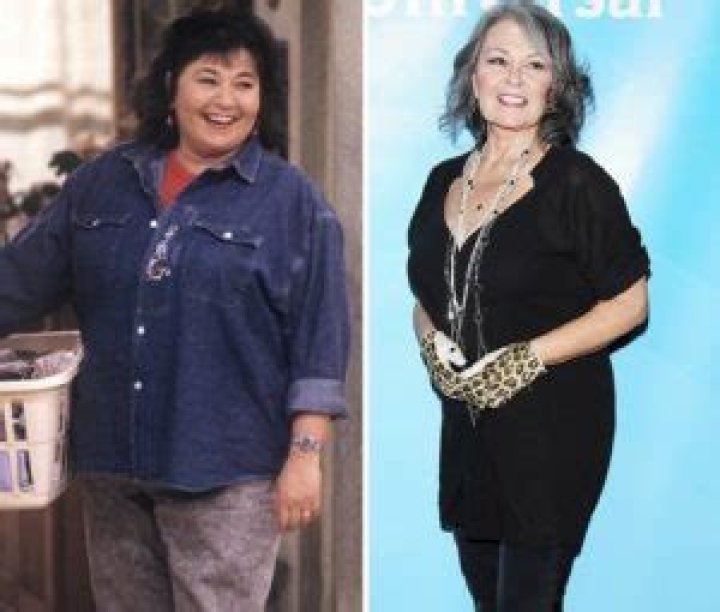 Roseanne Barr Before And After Plastic Surgery