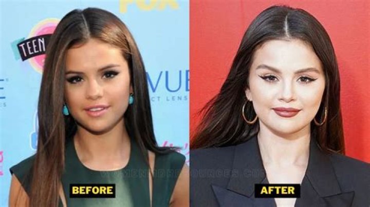 Selena Gomez Weight Gain beforeafter by Constantinecaeser on DeviantArt