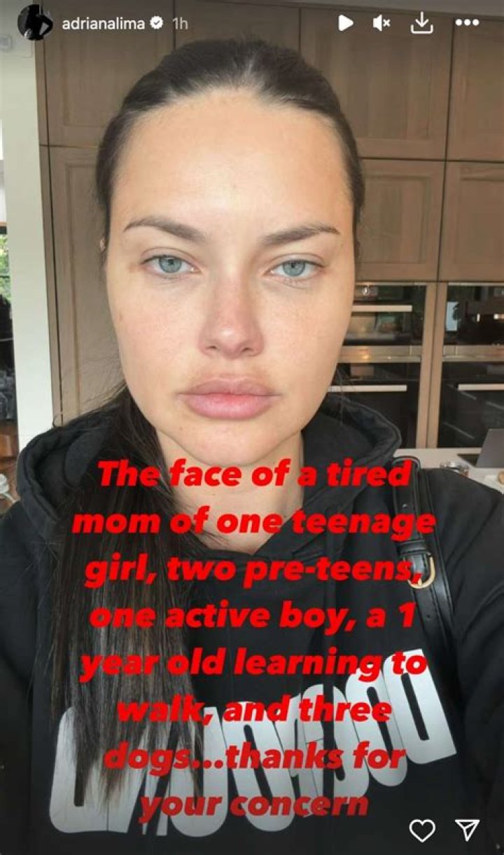 What happened to Adriana Lima Hot Imaginations