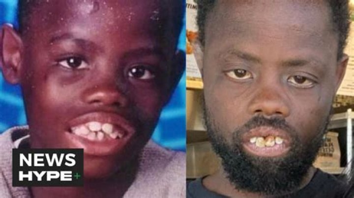 What Really Happened To Welven Da Great, Aka Deez Nuts Guy? Is The Deez